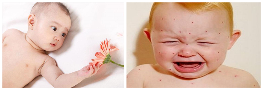 兒童濕疹反反復復，您有在家安裝家用除濕產(chǎn)品嗎？